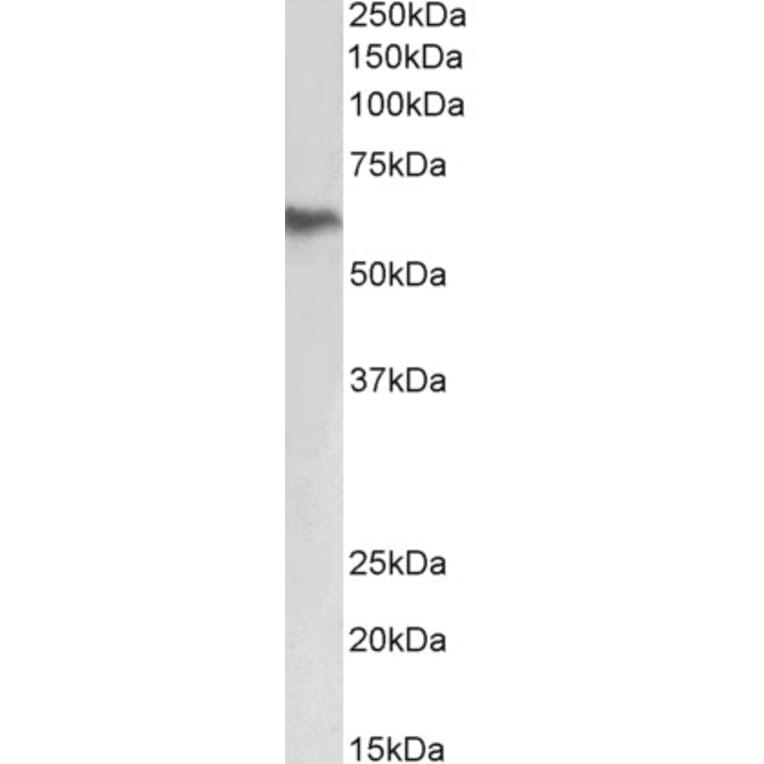 Western Blot - Anti-Fibrinogen beta Chain Antibody (A82848) - Antibodies.com