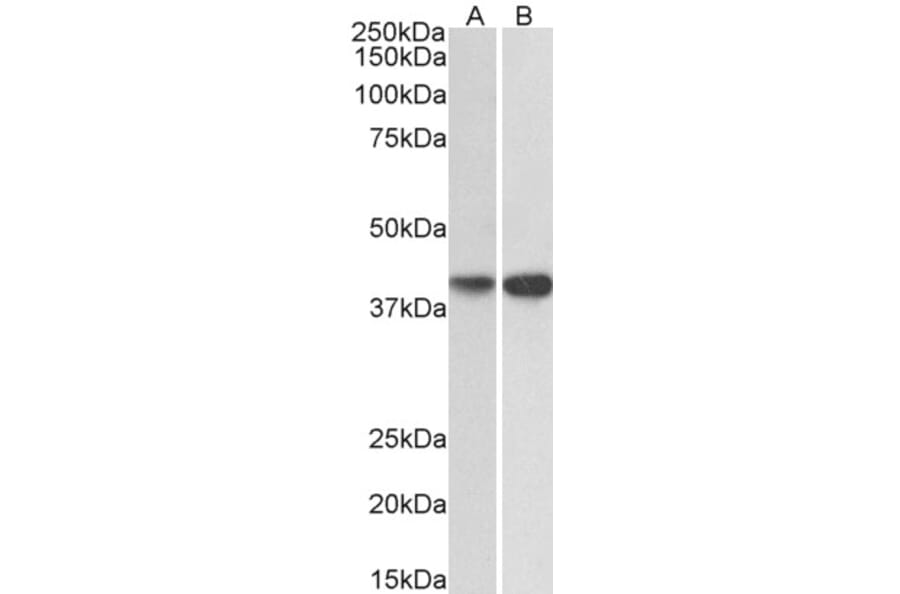 Western Blot - Anti-ENDOGL1/ENGL Antibody (A82849) - Antibodies.com