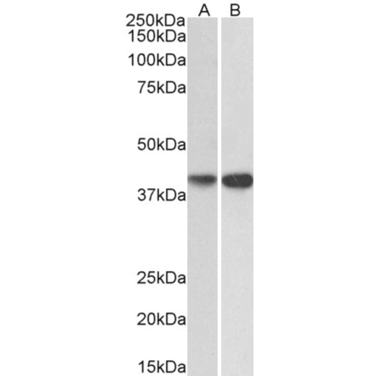 Western Blot - Anti-ENDOGL1/ENGL Antibody (A82849) - Antibodies.com