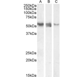 Western Blot - Anti-ROR gamma Antibody (A82850) - Antibodies.com