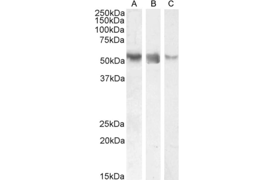 Western Blot - Anti-ROR gamma Antibody (A82850) - Antibodies.com