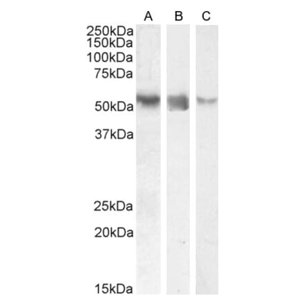 Western Blot - Anti-ROR gamma Antibody (A82850) - Antibodies.com