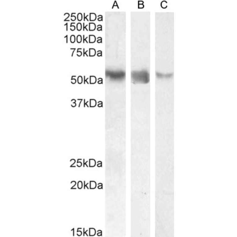 Western Blot - Anti-ROR gamma Antibody (A82850) - Antibodies.com