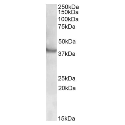 Western Blot - Anti-Rapsyn Antibody (A82851) - Antibodies.com