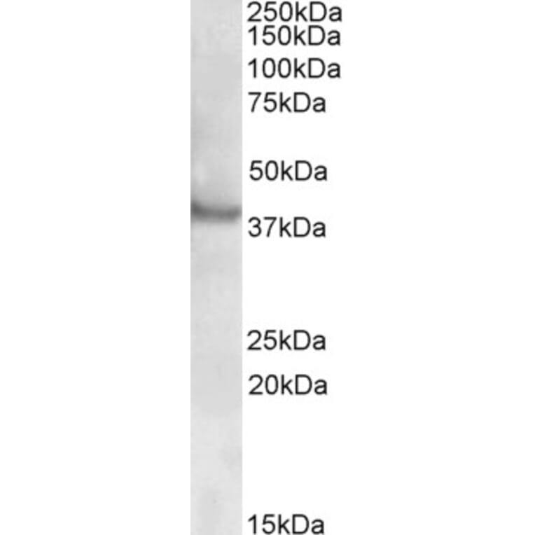 Western Blot - Anti-Rapsyn Antibody (A82851) - Antibodies.com