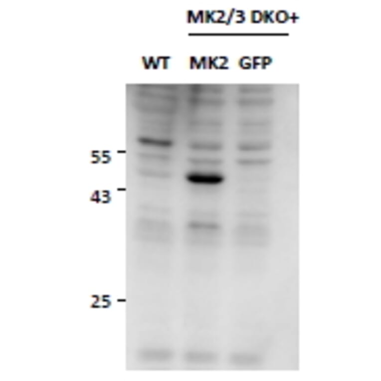 Western Blot - Anti-MK2 Antibody (A82852) - Antibodies.com