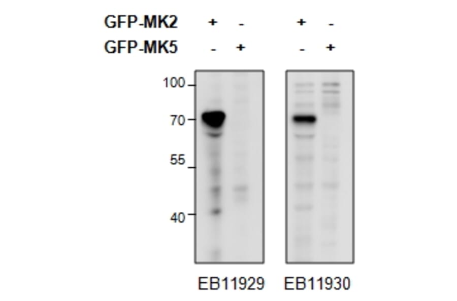 Western Blot - Anti-MK2 Antibody (A82852) - Antibodies.com