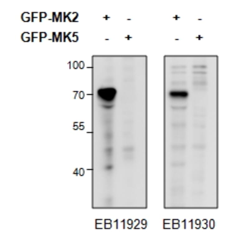 Western Blot - Anti-MK2 Antibody (A82852) - Antibodies.com