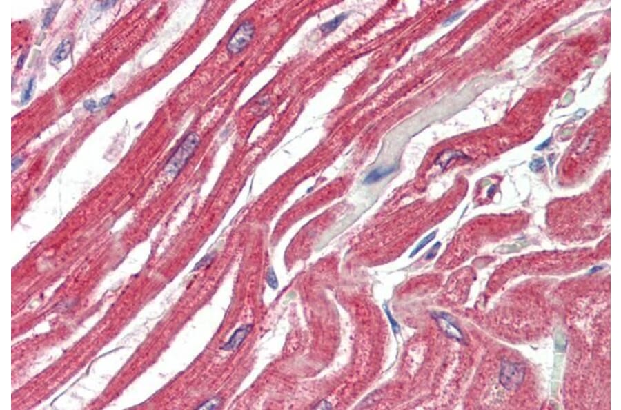 Immunohistochemistry - Anti-MK2 Antibody (A82852) - Antibodies.com