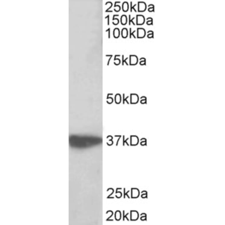 Western Blot - Anti-EMAP II/AIMP1 Antibody (A82855) - Antibodies.com