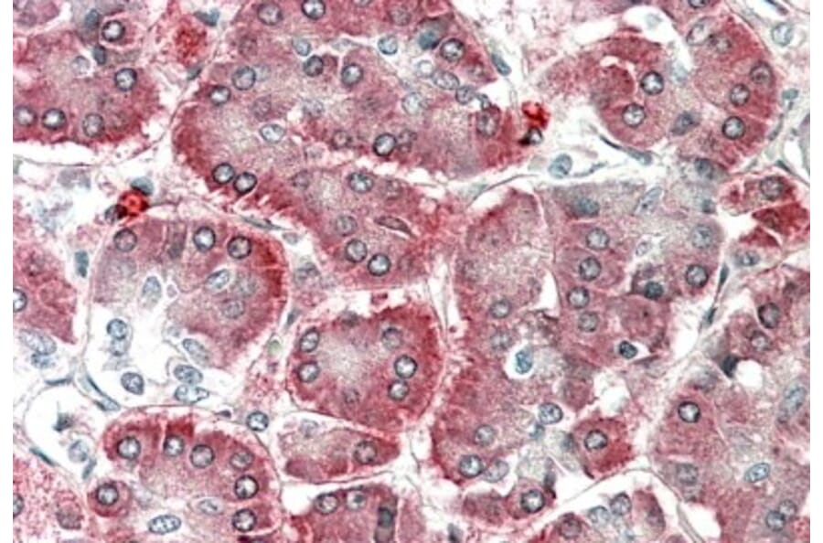 Immunohistochemistry - Anti-EMAP II/AIMP1 Antibody (A82856) - Antibodies.com
