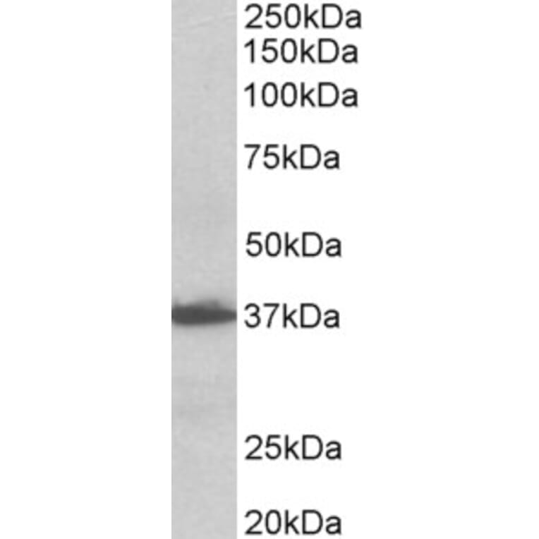 Western Blot - Anti-EMAP II/AIMP1 Antibody (A82856) - Antibodies.com