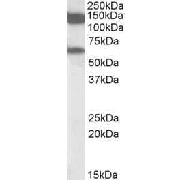 Western Blot - Anti-AF10 Antibody (A82857) - Antibodies.com