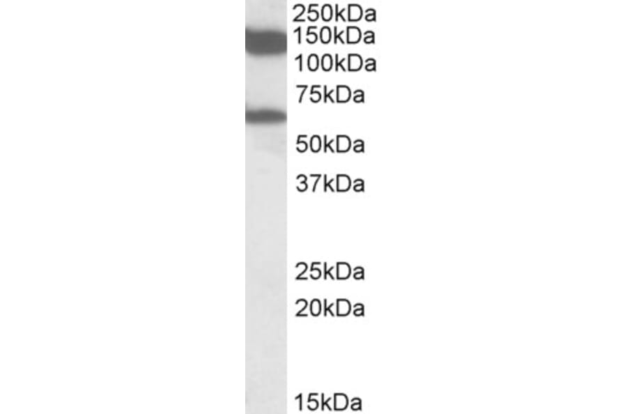 Western Blot - Anti-AF10 Antibody (A82857) - Antibodies.com
