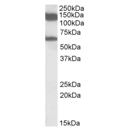 Western Blot - Anti-AF10 Antibody (A82857) - Antibodies.com