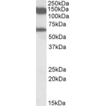 Western Blot - Anti-AF10 Antibody (A82857) - Antibodies.com