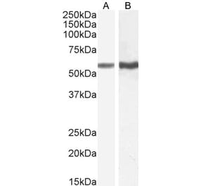 Western Blot - Anti-TGFBR1 Antibody (A82859) - Antibodies.com