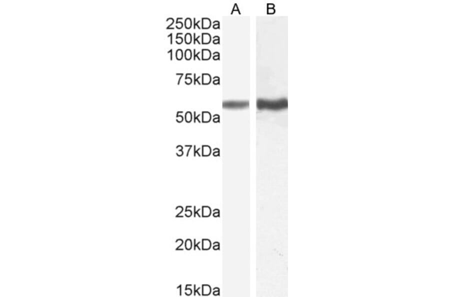 Western Blot - Anti-TGFBR1 Antibody (A82859) - Antibodies.com