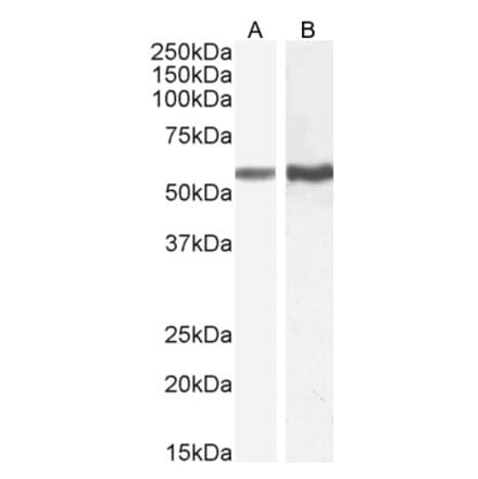 Western Blot - Anti-TGFBR1 Antibody (A82859) - Antibodies.com