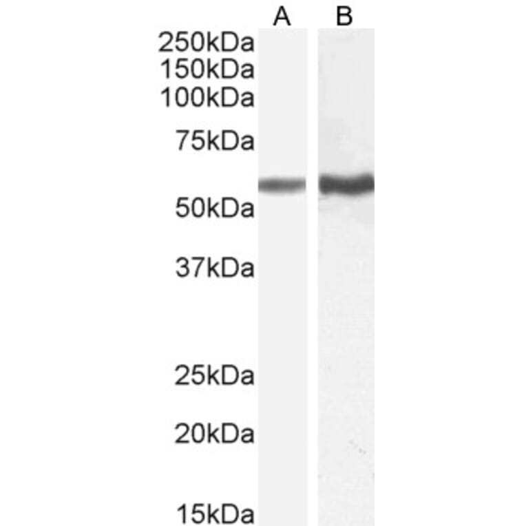 Western Blot - Anti-TGFBR1 Antibody (A82859) - Antibodies.com