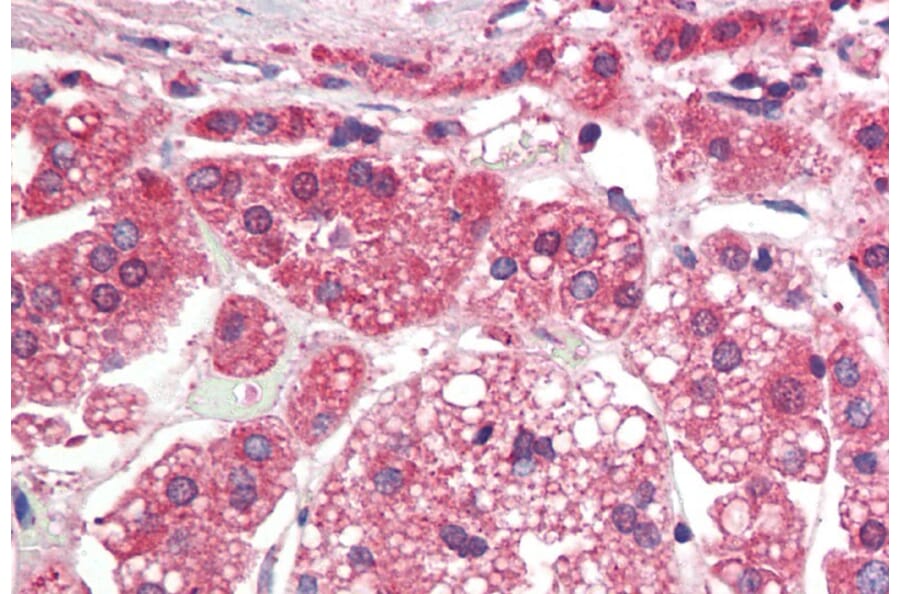 Immunohistochemistry - Anti-TGFBR1 Antibody (A82859) - Antibodies.com