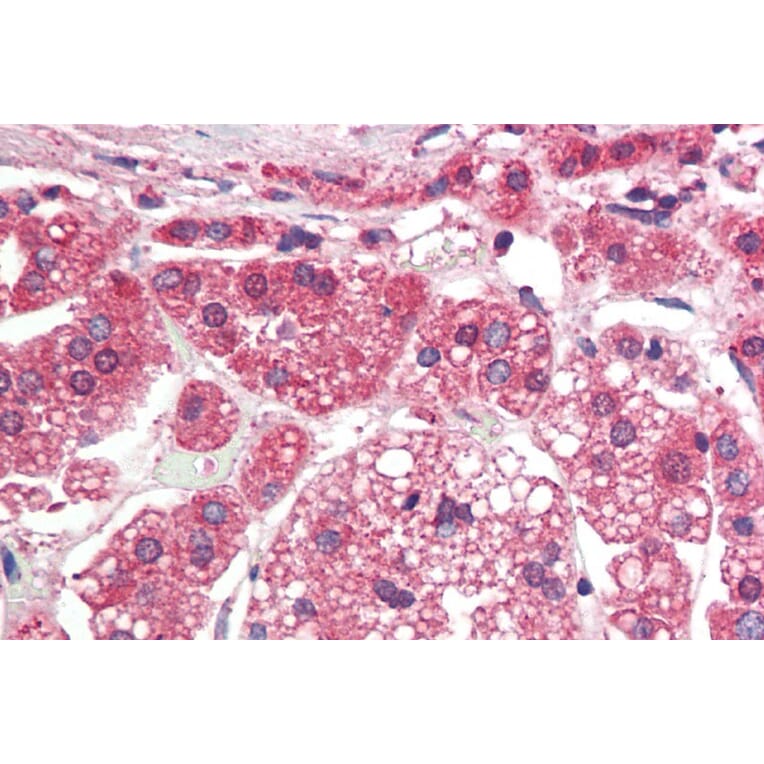 Immunohistochemistry - Anti-TGFBR1 Antibody (A82859) - Antibodies.com