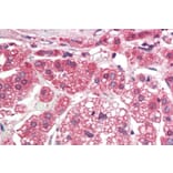 Immunohistochemistry - Anti-TGFBR1 Antibody (A82859) - Antibodies.com