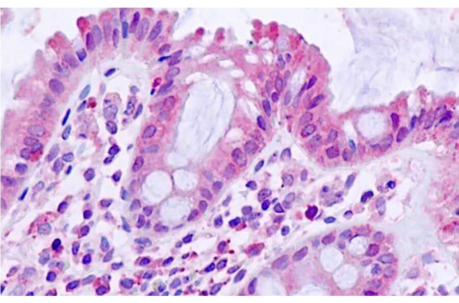 Immunohistochemistry - Anti-TGFBR1 Antibody (A82859) - Antibodies.com