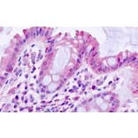 Immunohistochemistry - Anti-TGFBR1 Antibody (A82859) - Antibodies.com