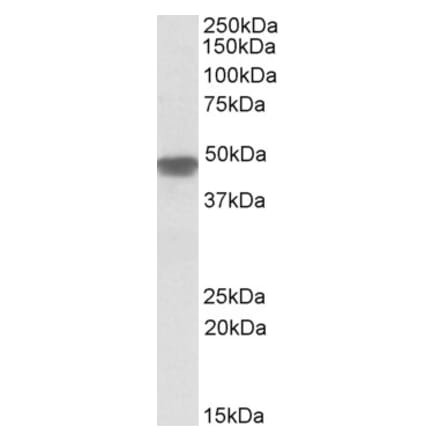 Western Blot - Anti-NDUFS2 Antibody (A82860) - Antibodies.com