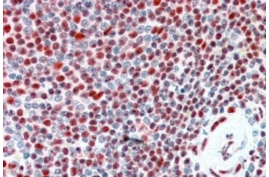 Immunohistochemistry - Anti-ILF2/NF45 Antibody (A82862) - Antibodies.com