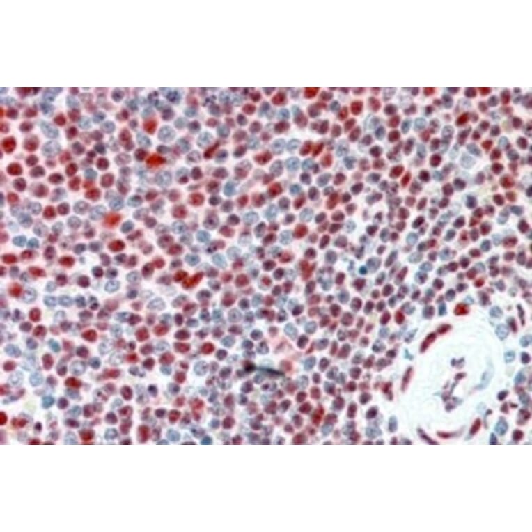 Immunohistochemistry - Anti-ILF2/NF45 Antibody (A82862) - Antibodies.com