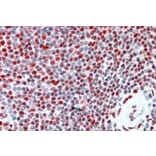 Immunohistochemistry - Anti-ILF2/NF45 Antibody (A82862) - Antibodies.com