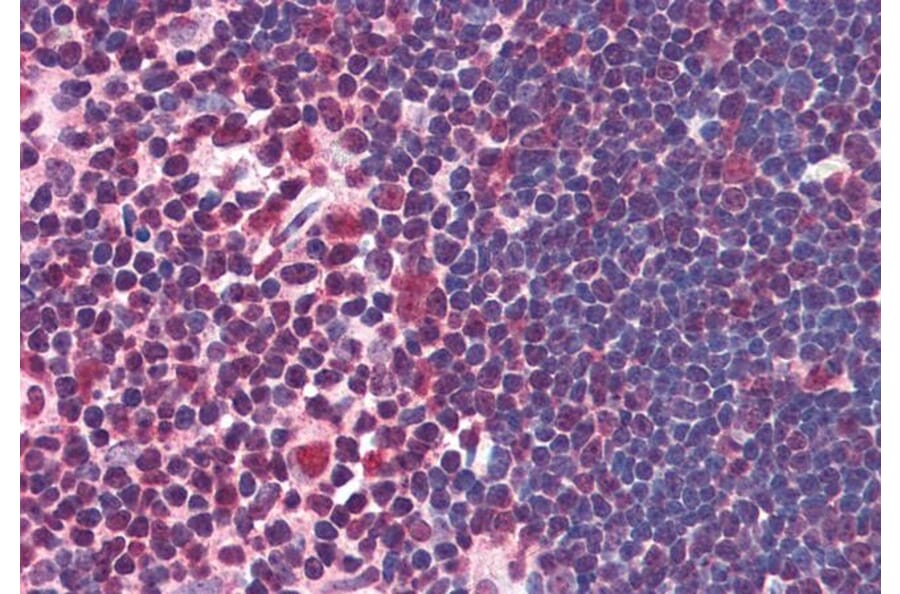 Immunohistochemistry - Anti-ILF2/NF45 Antibody (A82862) - Antibodies.com
