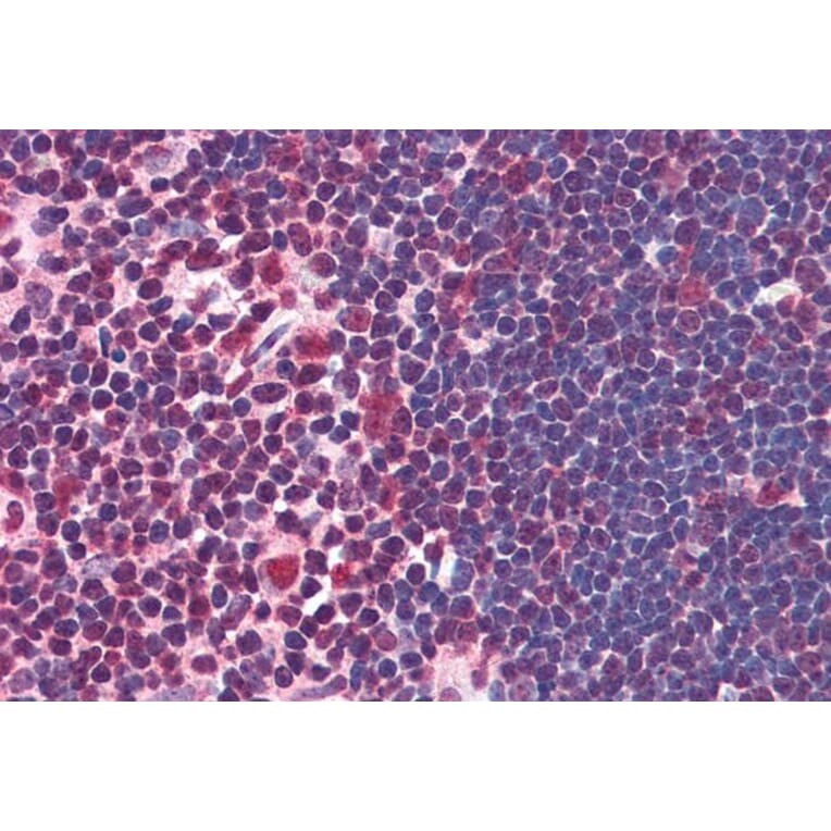 Immunohistochemistry - Anti-ILF2/NF45 Antibody (A82862) - Antibodies.com