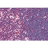 Immunohistochemistry - Anti-ILF2/NF45 Antibody (A82862) - Antibodies.com