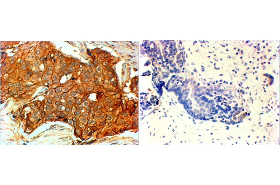 Immunohistochemistry - Anti-ErbB2/HER2 Antibody (A82863) - Antibodies.com