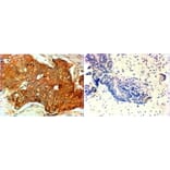 Immunohistochemistry - Anti-ErbB2/HER2 Antibody (A82863) - Antibodies.com