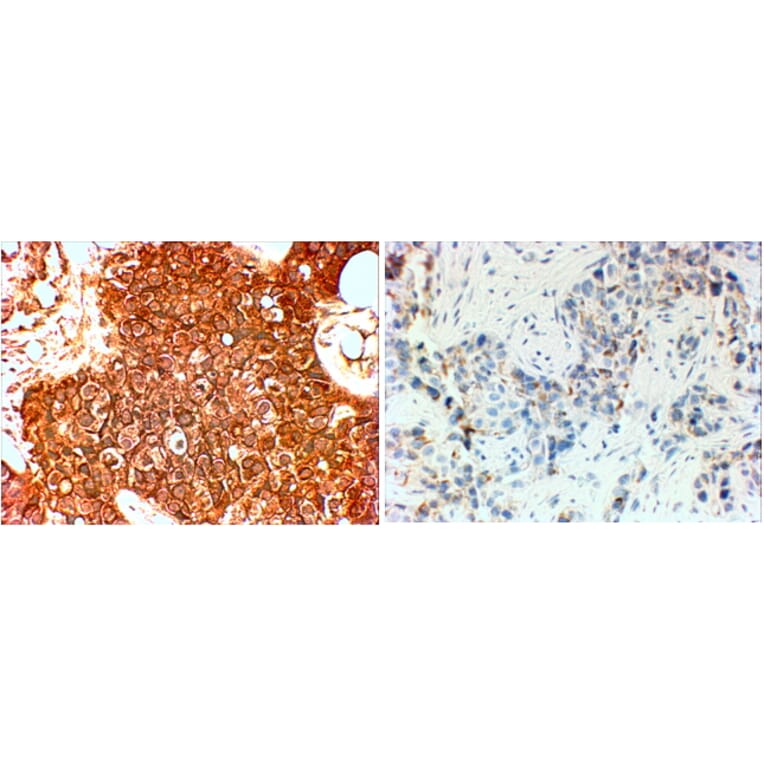 Immunohistochemistry - Anti-ErbB2/HER2 Antibody (A82864) - Antibodies.com
