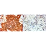 Immunohistochemistry - Anti-ErbB2/HER2 Antibody (A82864) - Antibodies.com