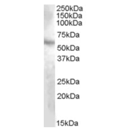 Western Blot - Anti-DMP1 Antibody (A82865) - Antibodies.com