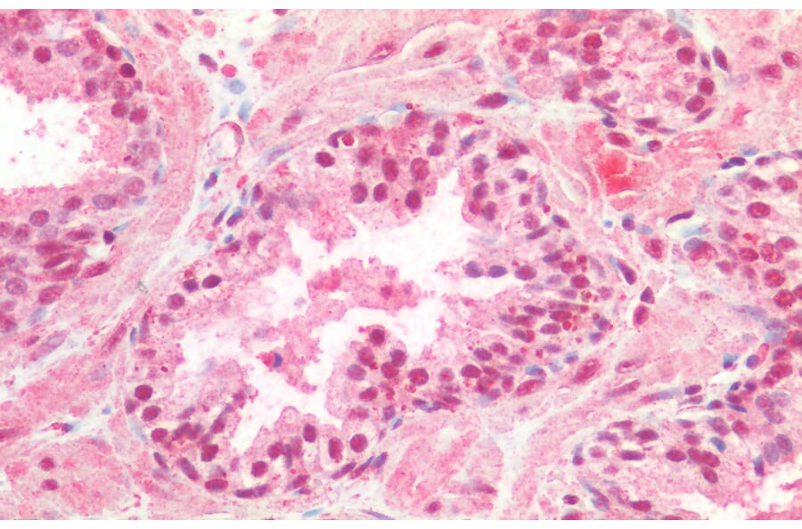 Immunohistochemistry - Anti-CREB Antibody (A82866) - Antibodies.com