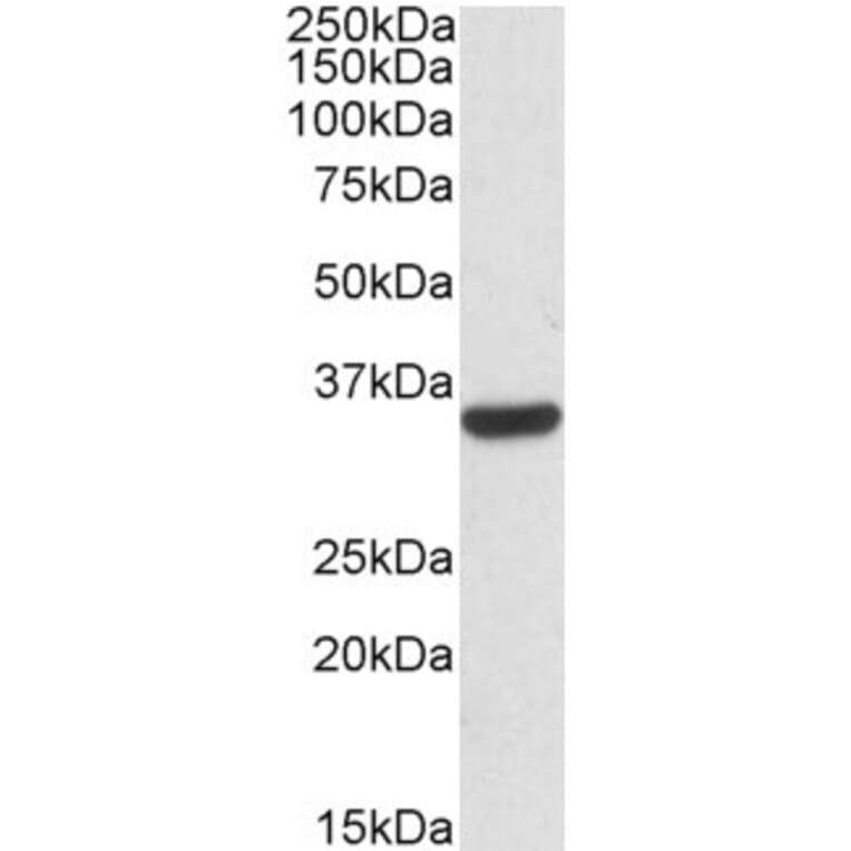 Western Blot - Anti-Calponin 2 Antibody (A82867) - Antibodies.com