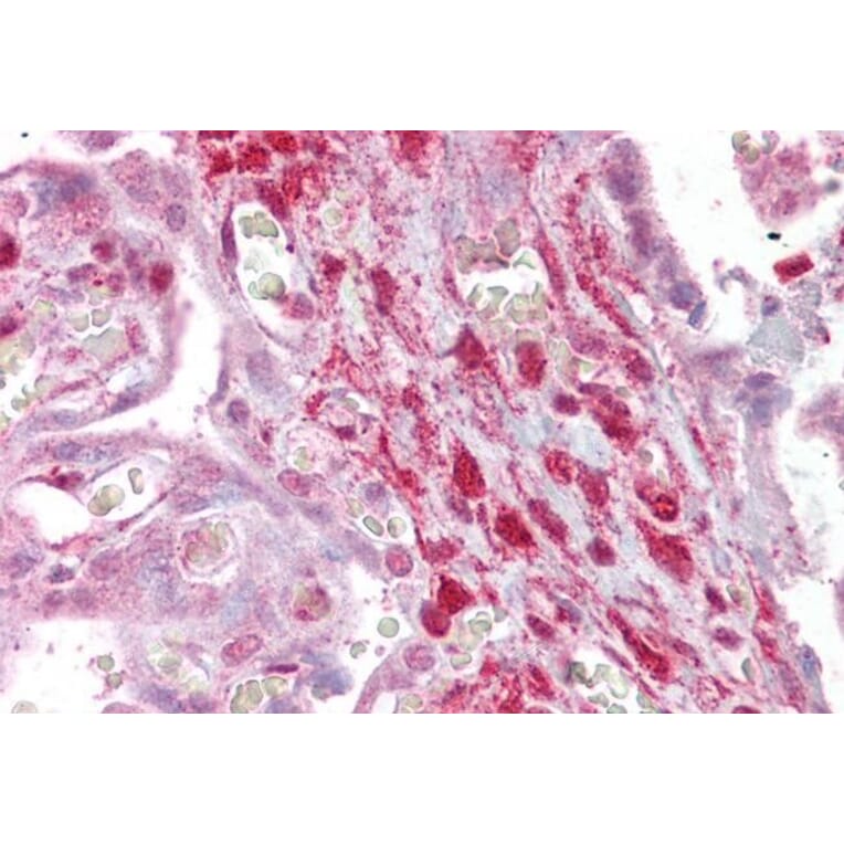 Immunohistochemistry - Anti-Calponin 2 Antibody (A82867) - Antibodies.com