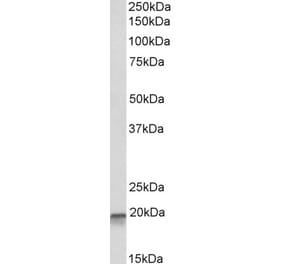 Western Blot - Anti-AIMP3/p18 Antibody (A82868) - Antibodies.com