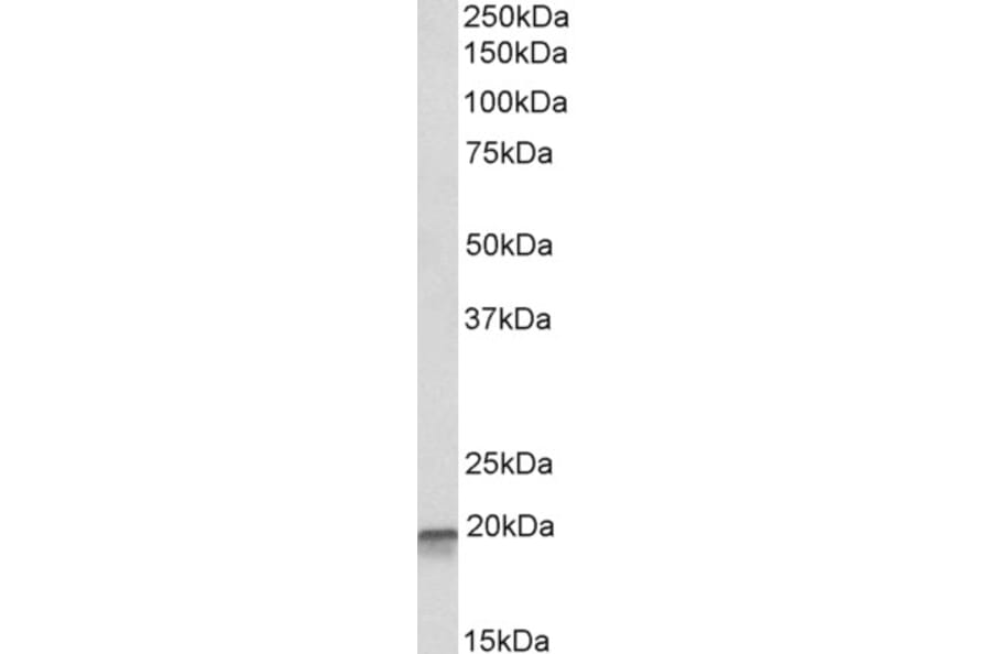Western Blot - Anti-AIMP3/p18 Antibody (A82868) - Antibodies.com