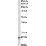 Western Blot - Anti-AIMP3/p18 Antibody (A82868) - Antibodies.com