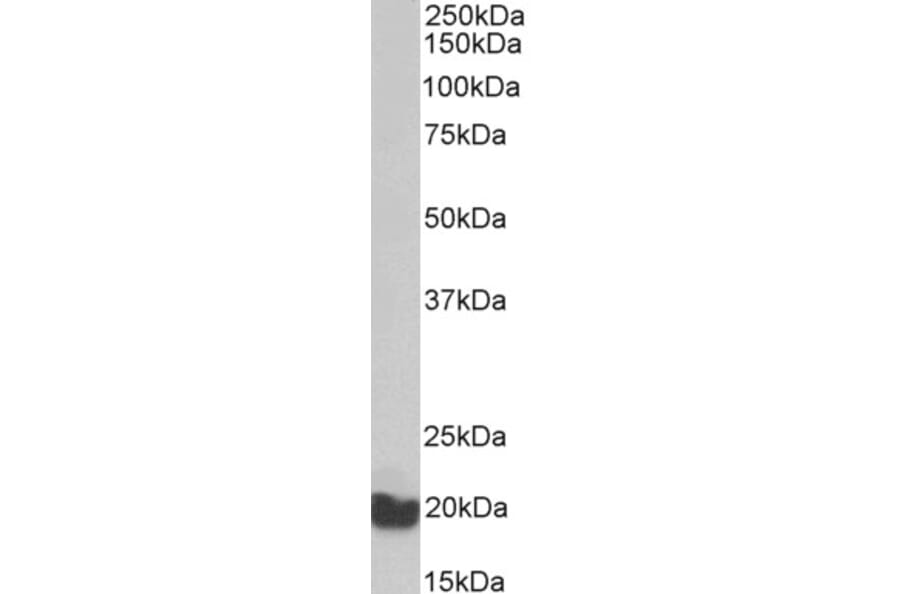 Western Blot - Anti-AIMP3/p18 Antibody (A82868) - Antibodies.com