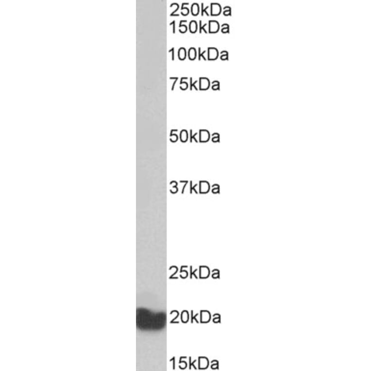 Western Blot - Anti-AIMP3/p18 Antibody (A82868) - Antibodies.com