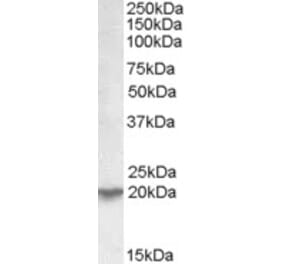 Western Blot - Anti-UXT Antibody (A82869) - Antibodies.com